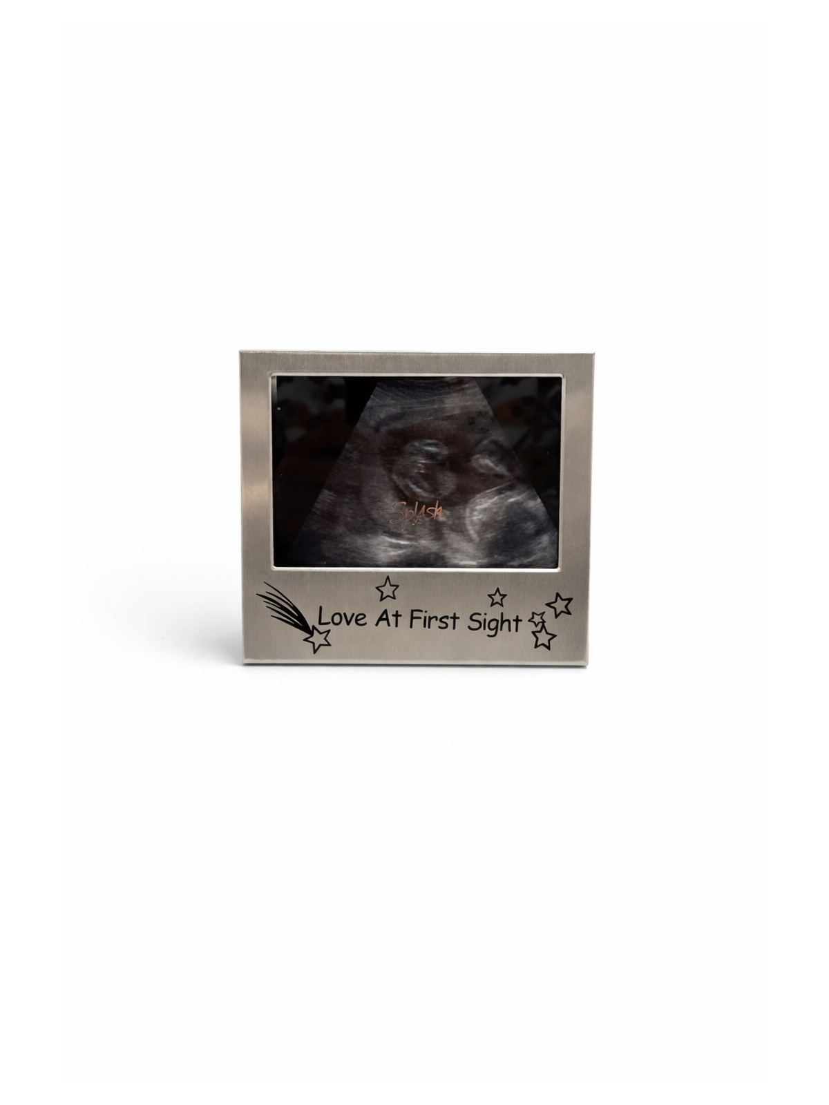 Baby Ultrasound Keepsake Frame